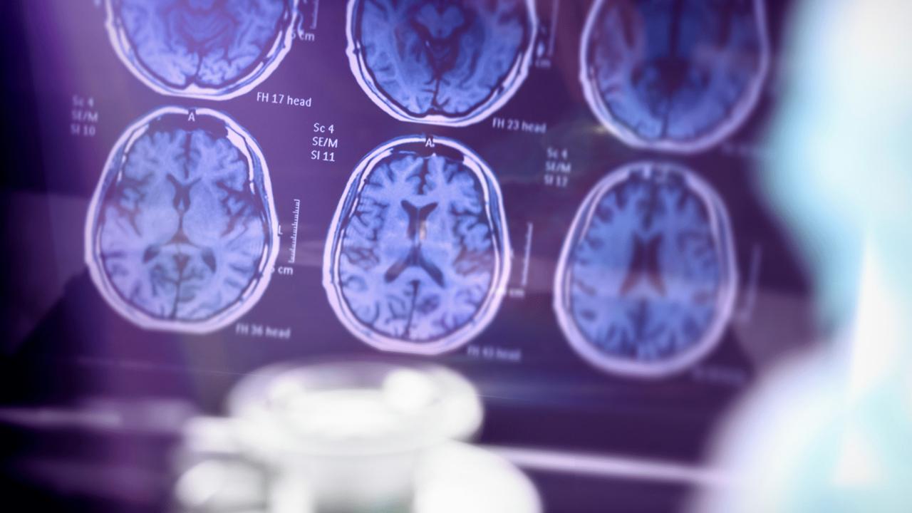 Bilim insanları Alzheimer’ı farelerde tersine çevirdi