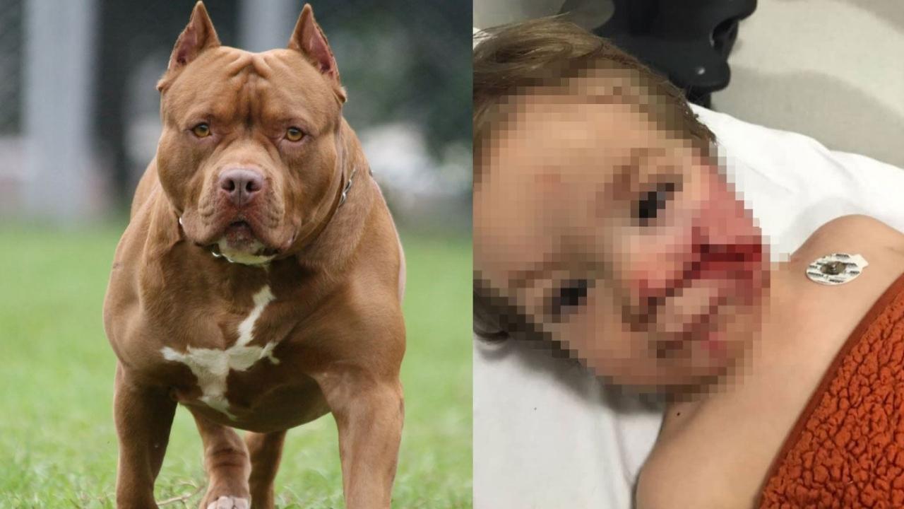 Minik Efe'nin yüzündeki ısırık izleri kalıcı olacak