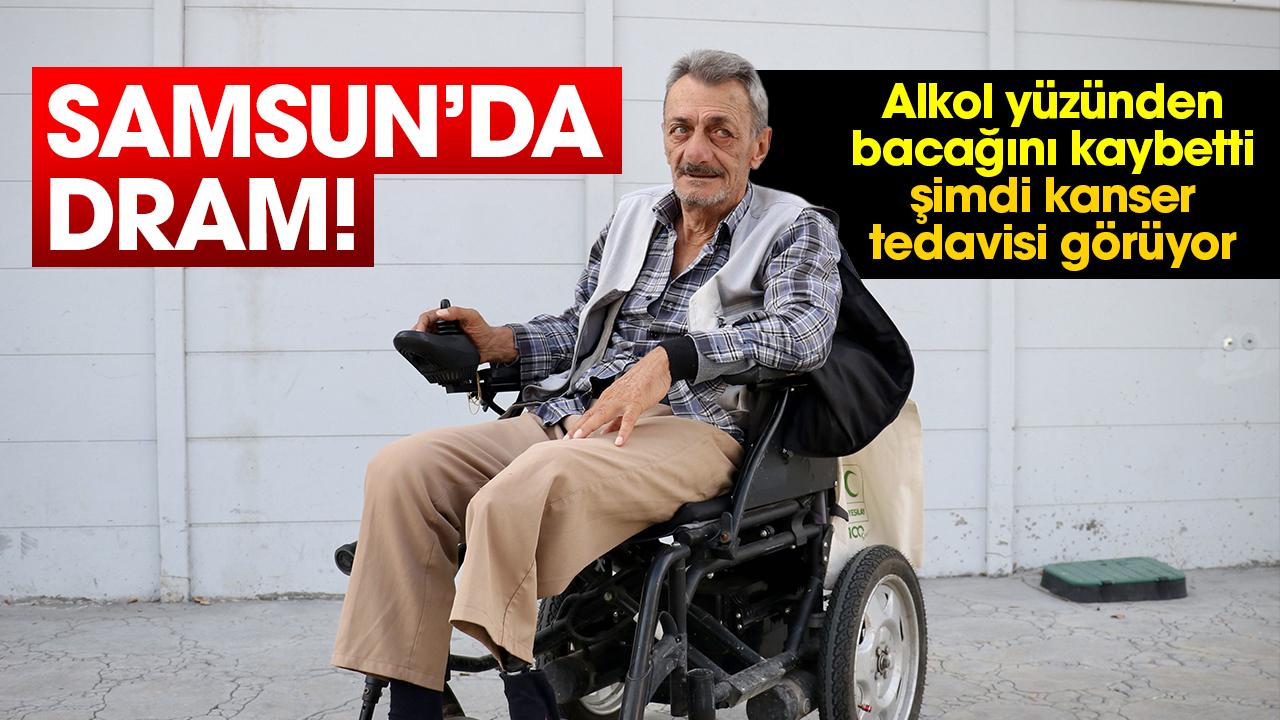 Samsun’da dram! Alkol yüzünden bacağını kaybetti, şimdi kanser tedavisi görüyor
