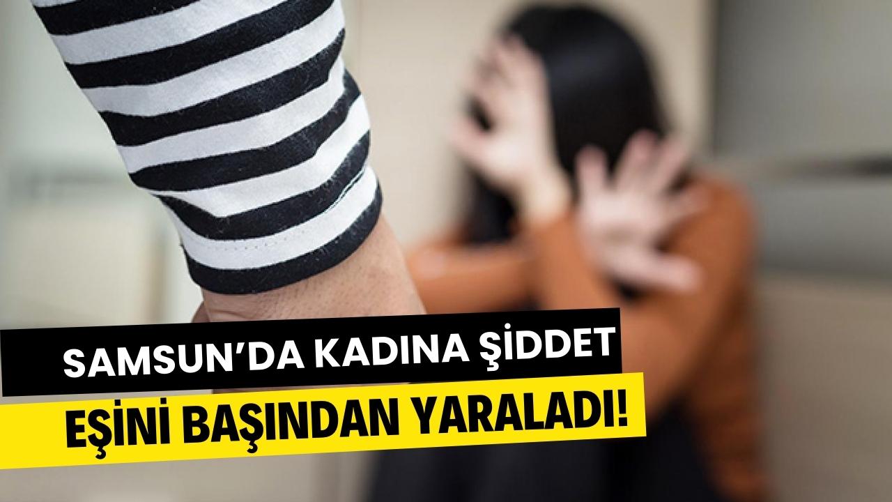 Samsun’da kadına şiddet! Eşini başından yaraladı