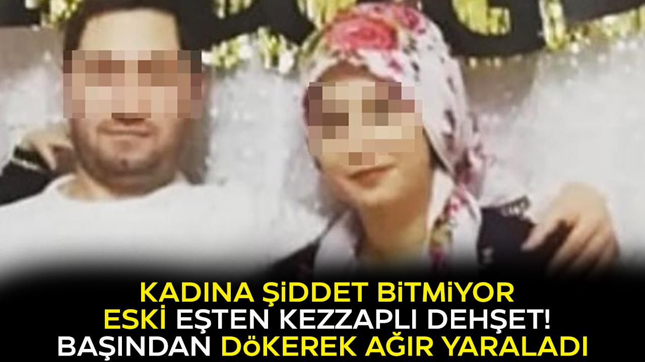 Eski koca vahşeti! Eski eşinin başına kezzap döktü!