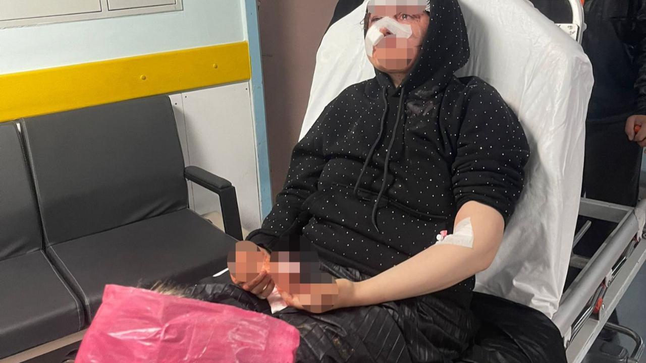 Kadına şiddet! Boşanmak istedi öldüresiye dövüldü