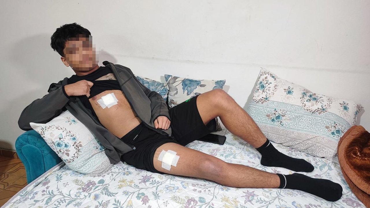 Kavga sebebi kız meselesi: Göğsünden ve bacaklarından bıçakladı