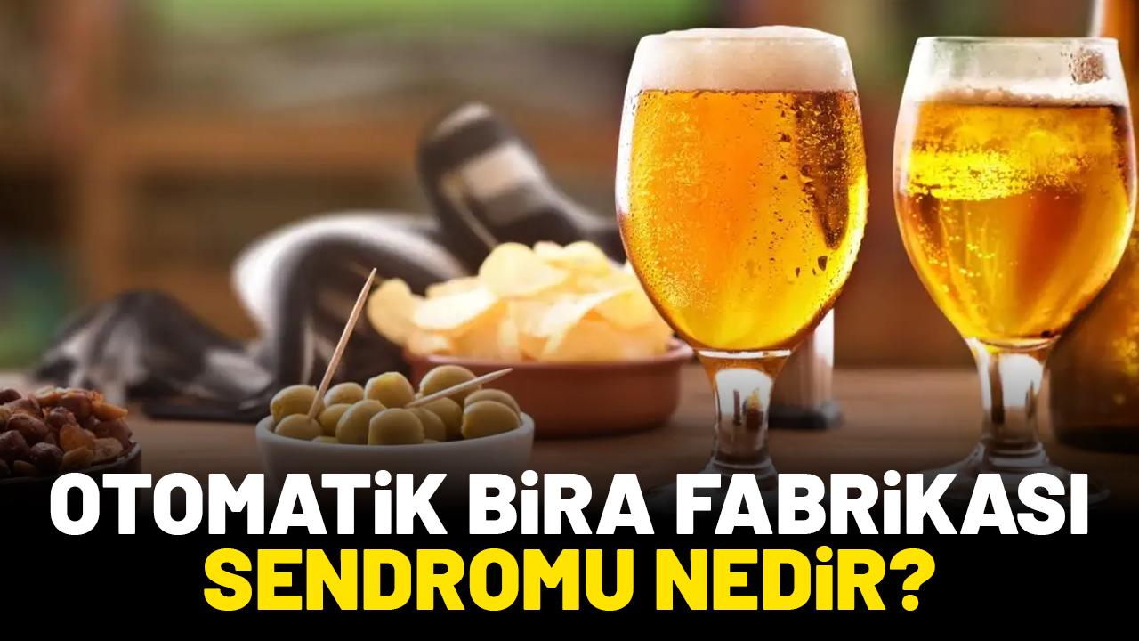 Otomatik bira fabrikası sendromu nedir?