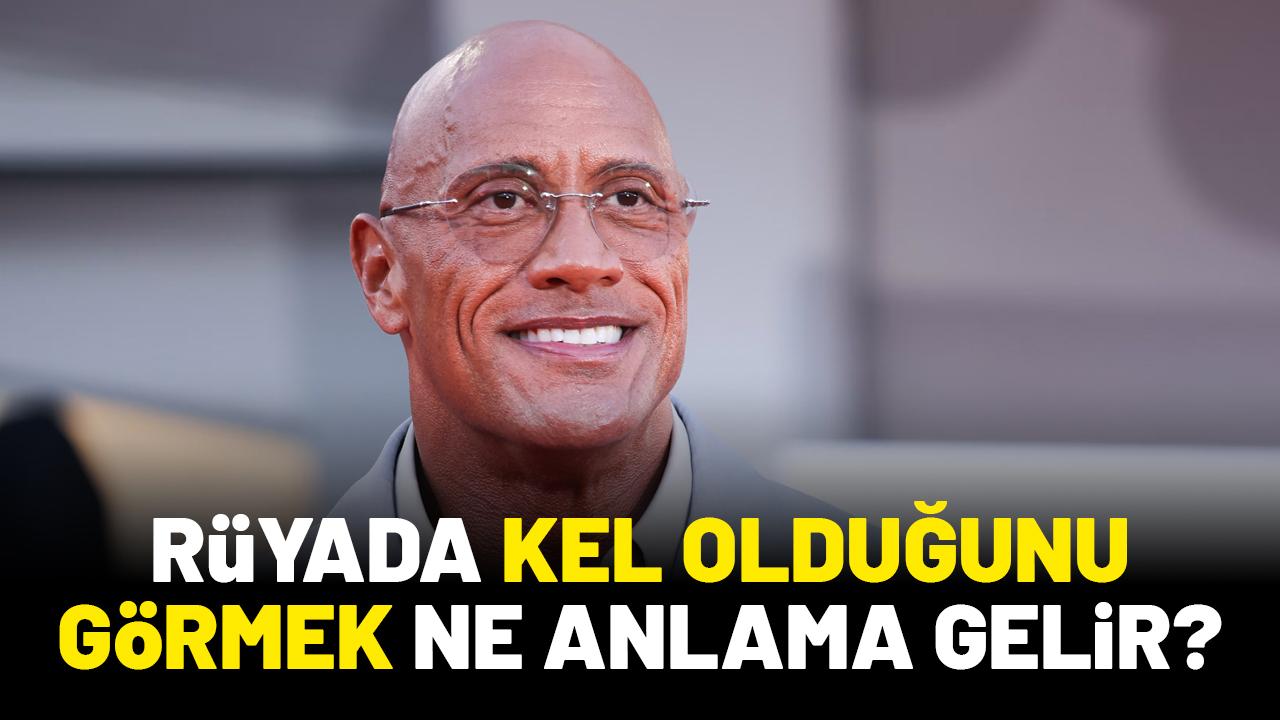 Rüyada kel olduğunu görmek ne anlama gelir?