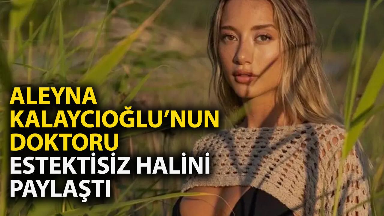 Aleyna Kalacıoğlu kimdir? Estetiksiz hali gündeme bomba gibi düştü