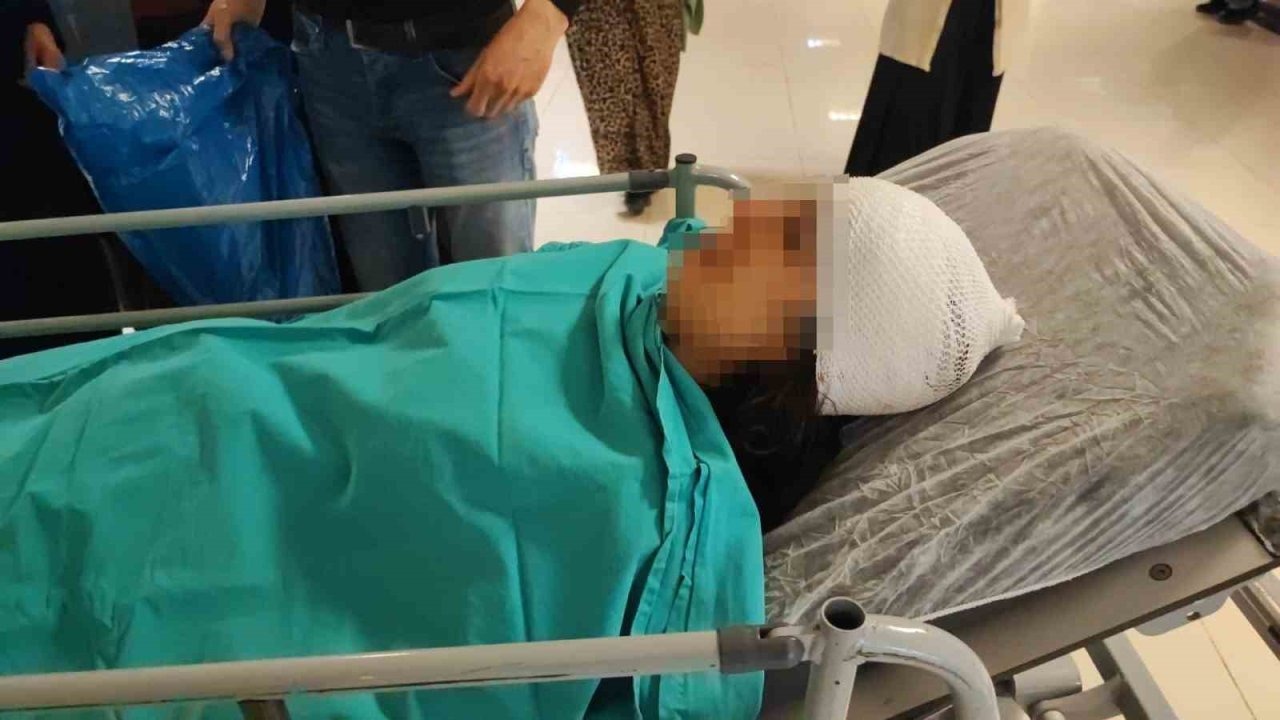 Ekmek almaya giderken sokak köpeklerinin saldırısına uğradı