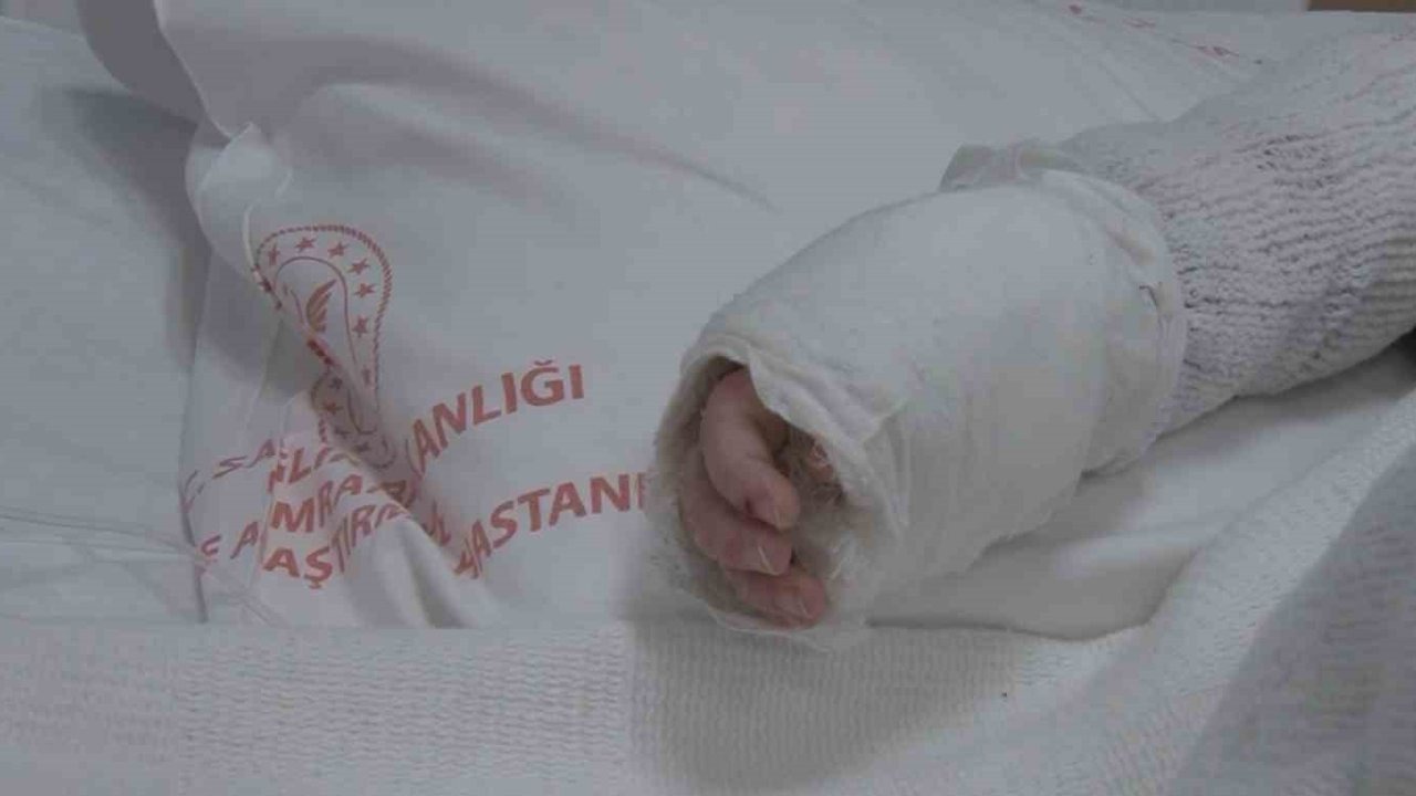 Üzerine kaynar su dökülen bebeğin vücudunun yüzde 27’si yandı