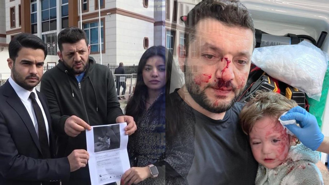 Yalova'da 14 aylık bebeğin yaralandığı saldırıda pes dedirten savunma