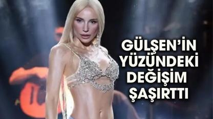 Gülşen'in yüzündeki değişim şaşırttı