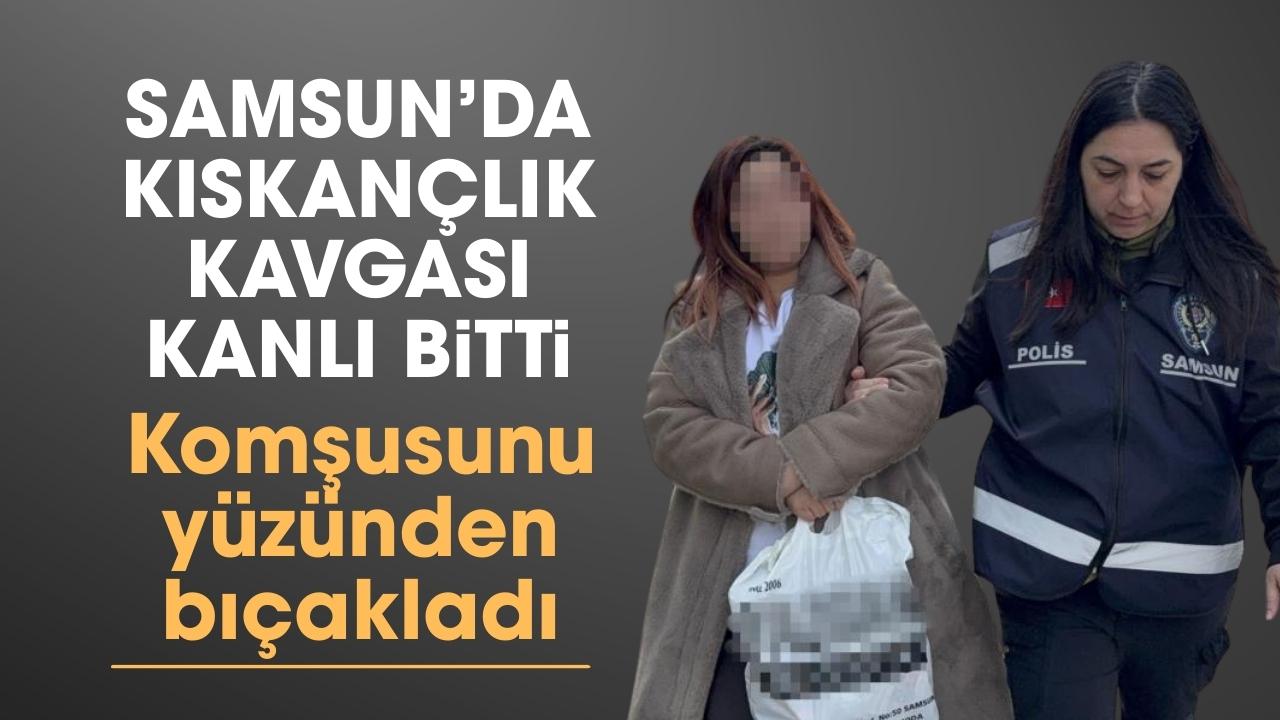 Samsun'da komşusunu yüzünden bıçakladı