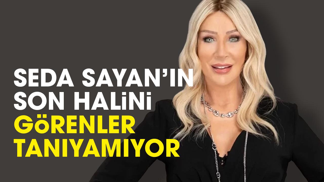 Seda Sayan'ın son halini görenler tanıyamıyor