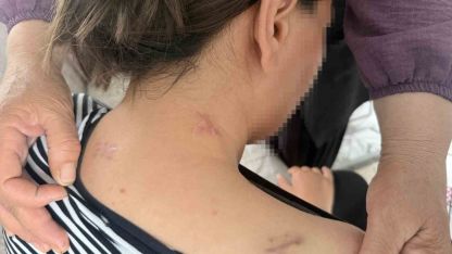 17 bıçak darbesi aldı, ölü numarasıyla kurtuldu