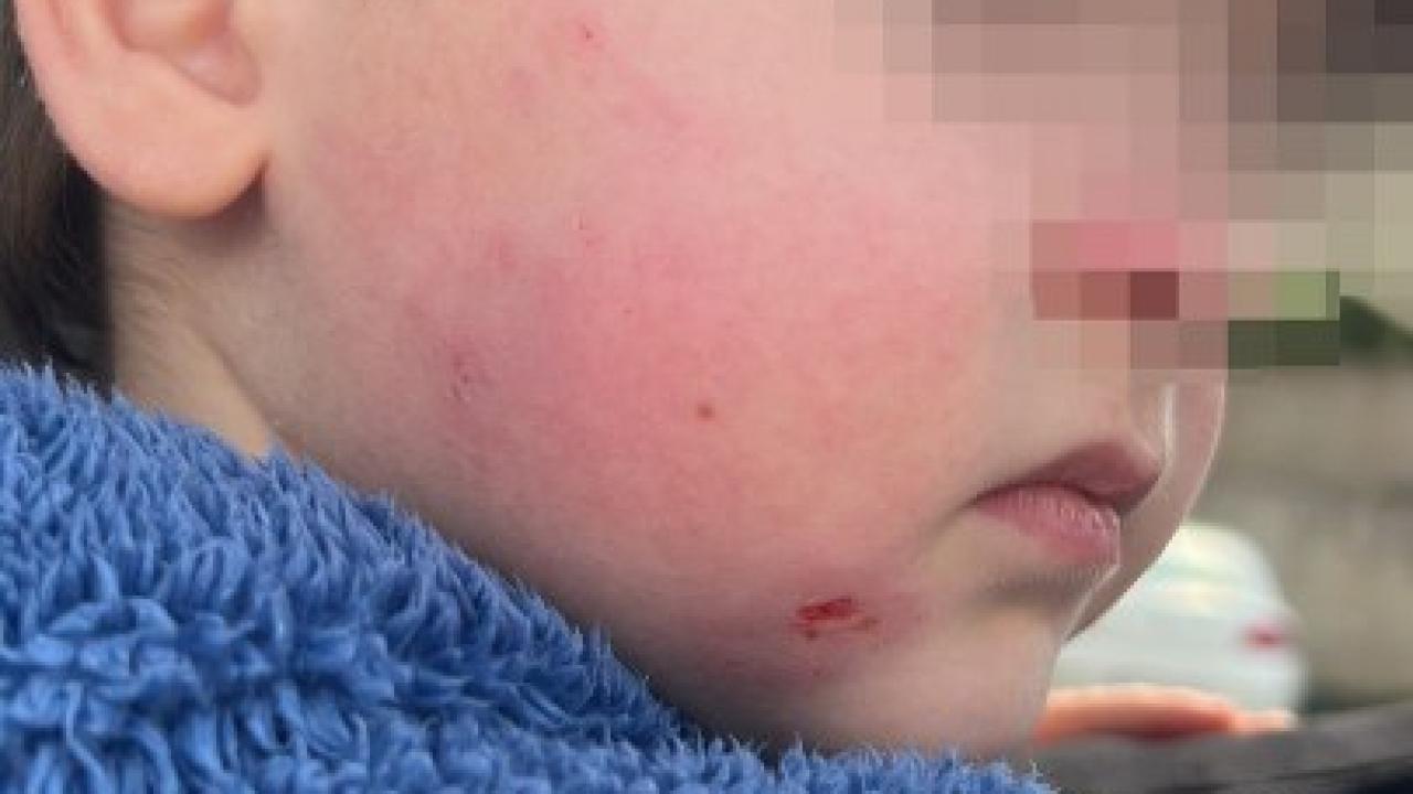 Kreşte çocuğa darp iddiası