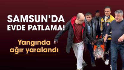 Samsun'da evde patlama! Tufan Yeşilot ağır yaralandı