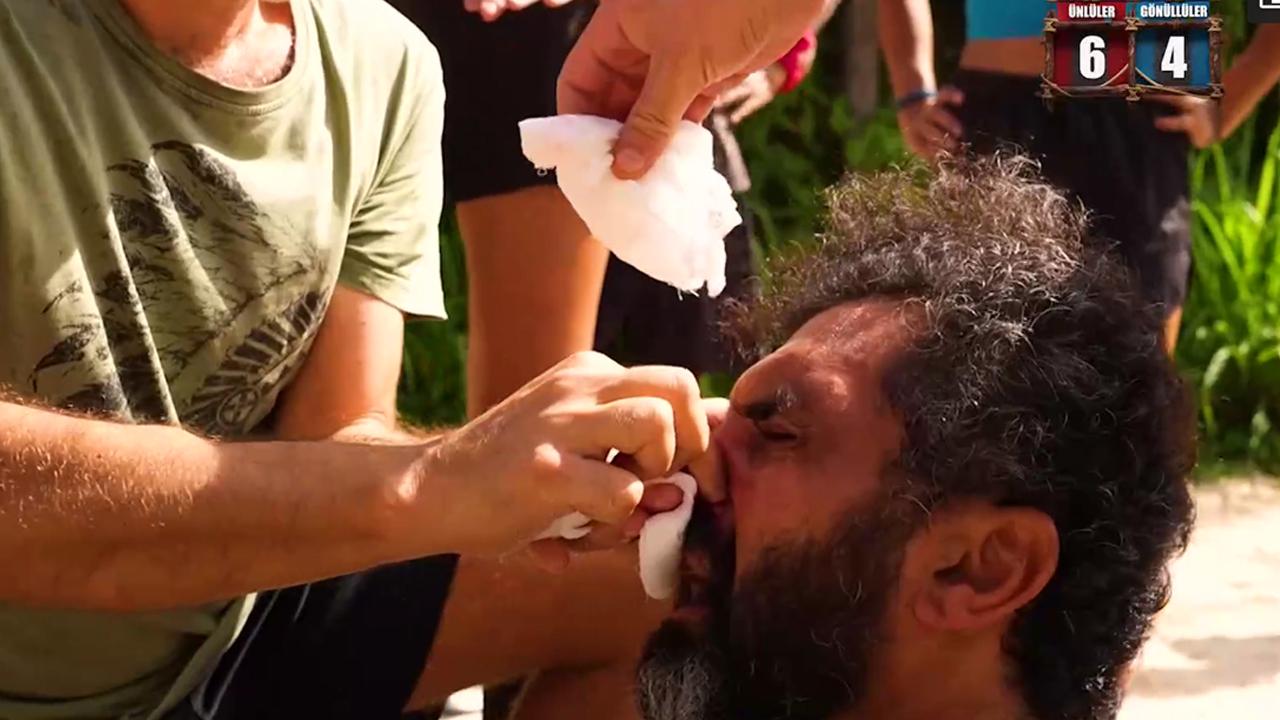 Survivor Bayhan kanlar içinde kaldı! Bayhan sakatlandı mı? Bayhan'a ne oldu?