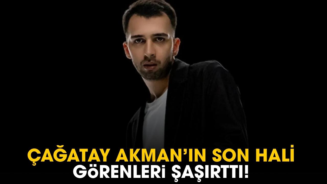 Çağatay Akman'ın son hali görenleri şaşırttı