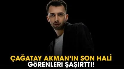 Çağatay Akman'ın son hali görenleri şaşırttı