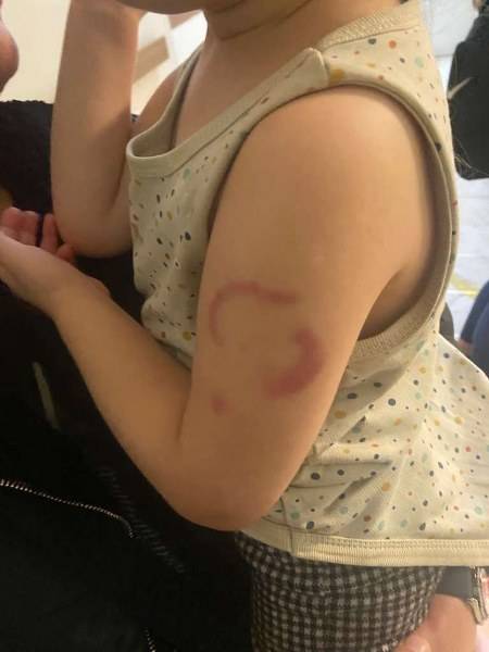 3 yaşındaki öğrencisini ısıran öğretmen tutuklandı