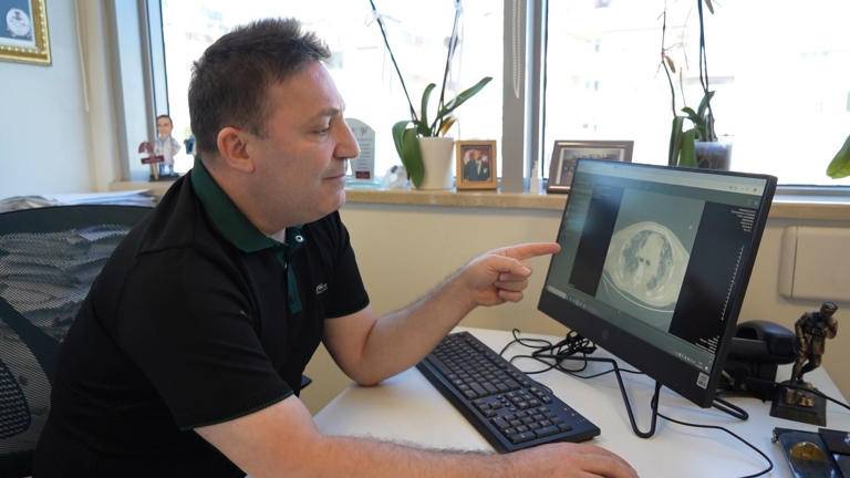 Yeni varyant 'Frankenstein' Samsun'da dalga dalga yayılıyor!