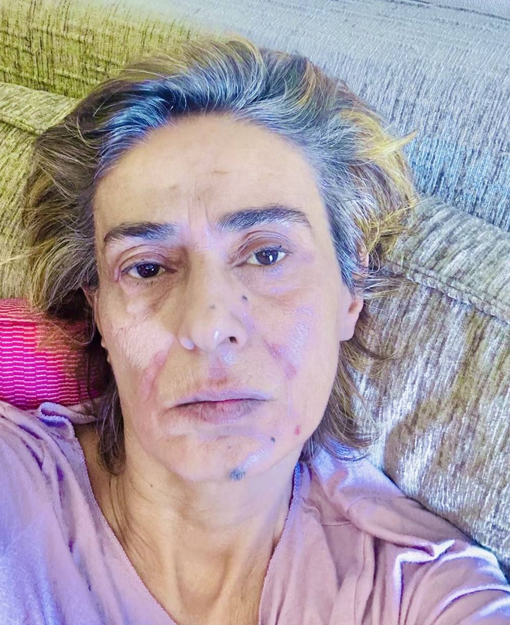 Yıldız Tilbe'den yeni paylaşım: Yüzünün hali endişelendirdi