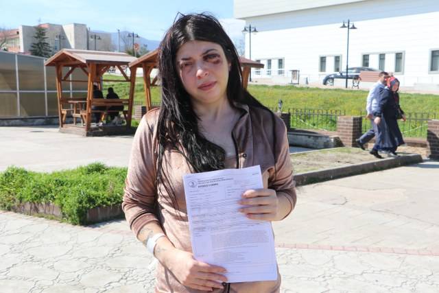 Damla'yı sokakta darp etti! 3 yıl 8 ay hapis cezası aldı