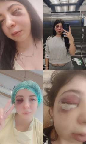 Damla'yı sokakta darp etti! 3 yıl 8 ay hapis cezası aldı