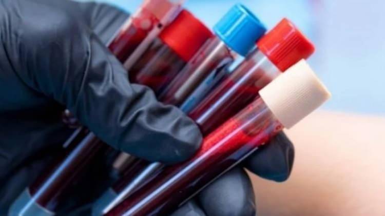 Acıya en dayanıklı kan grubu hangisi?