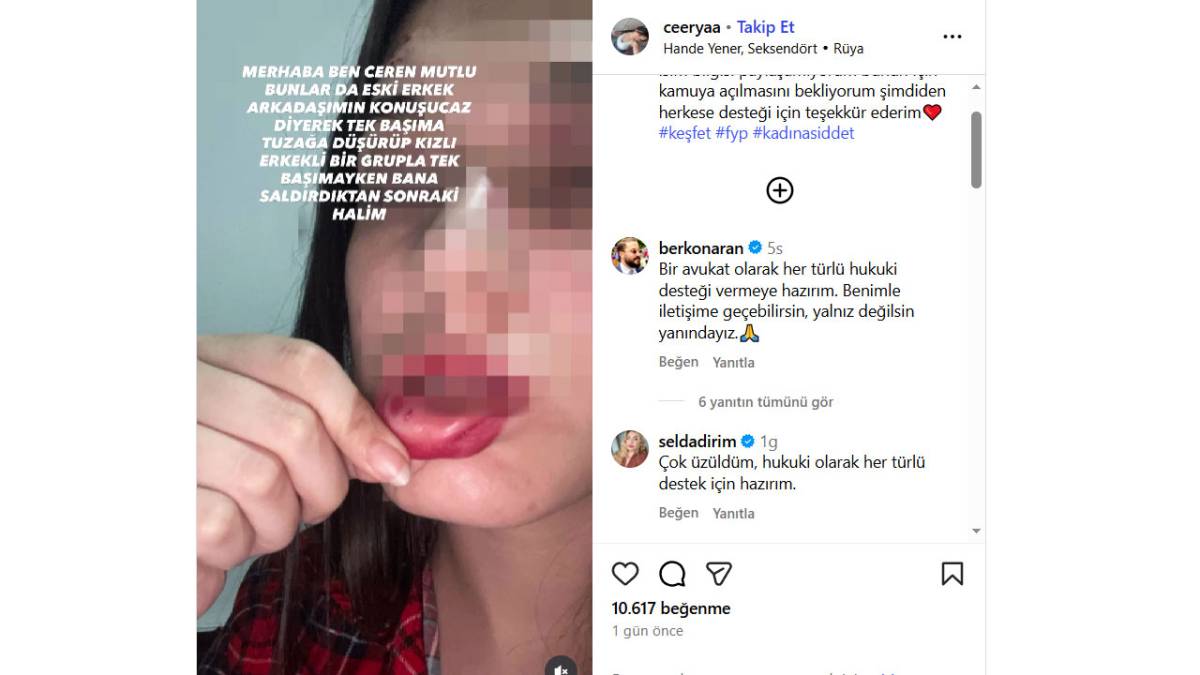 Samsun'da kadına öldüresiye darp iddiası! Ceren Mutlu destek istedi! 