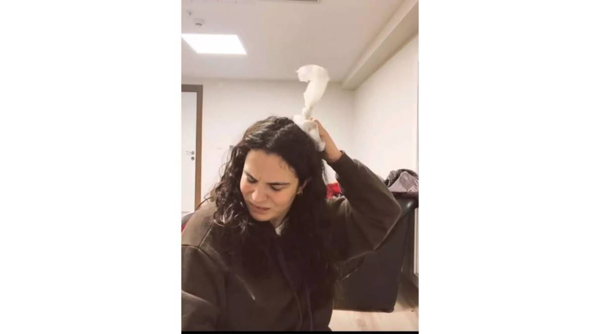 Oyuncu Aslı Bekiroğlu'nun kafasına kapı düştü