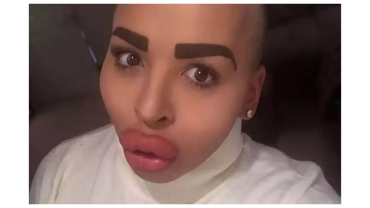 Estettik bağımlısı fenomen hayatını kaybetti