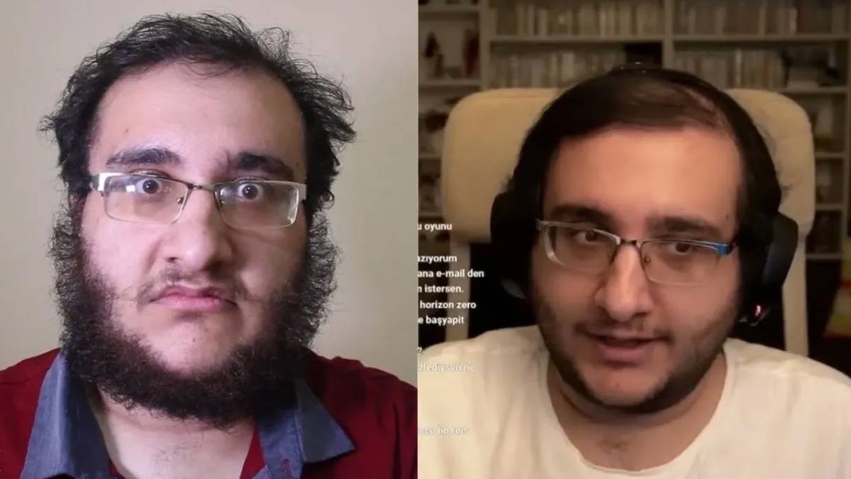 YouTuber Dost Kayaoğlu kimdir, Dost Kayaoğlu'nun hastalığı ne?