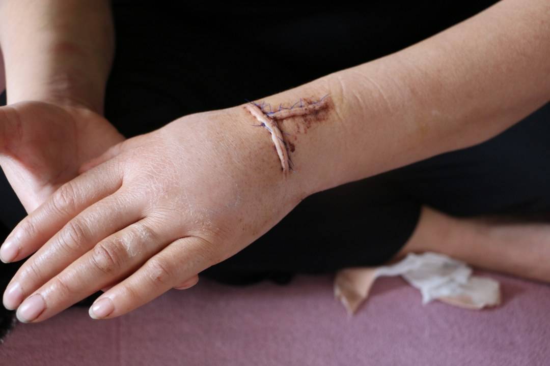 Diyarbakır’da dehşet! Birlikte yaşadığı kadına pusu kurup 30 yerinden bıçakladı