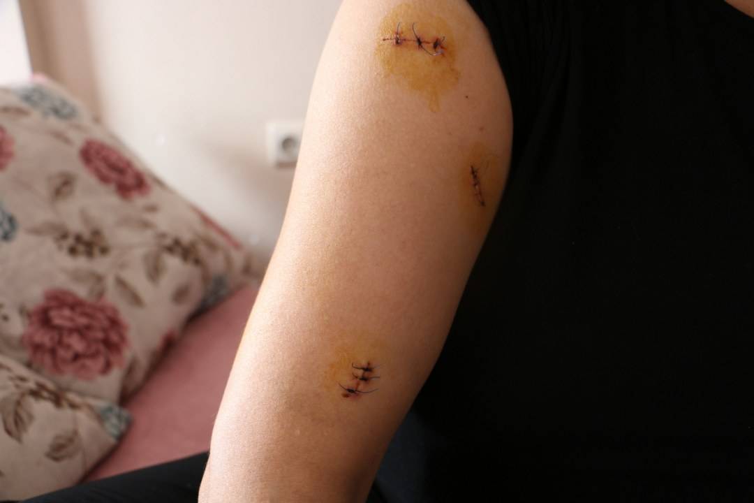 Diyarbakır’da dehşet! Birlikte yaşadığı kadına pusu kurup 30 yerinden bıçakladı