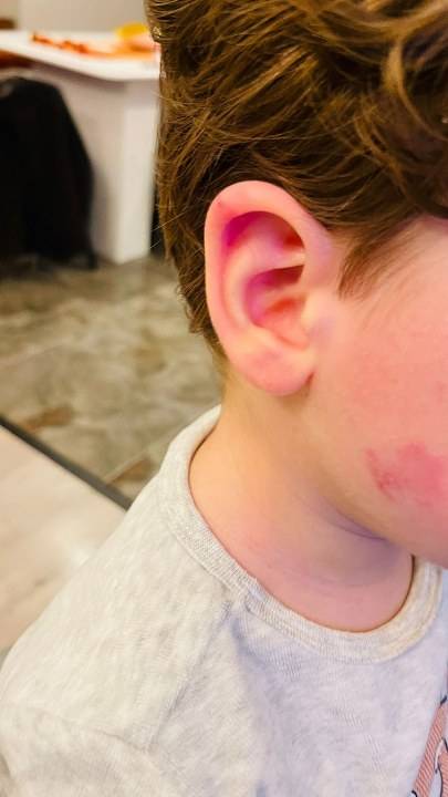 Kreşte çocuğa darp iddiası