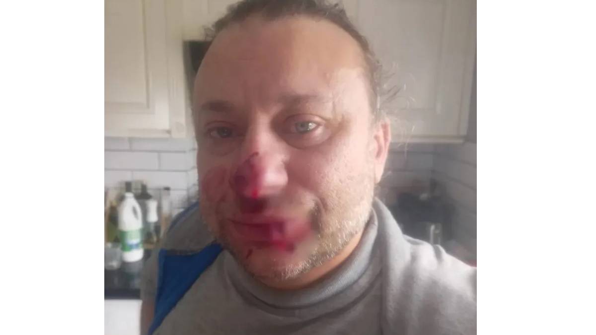 Onur Akay kimdir? Onur Akay'ın sağlık durumu nasıl?