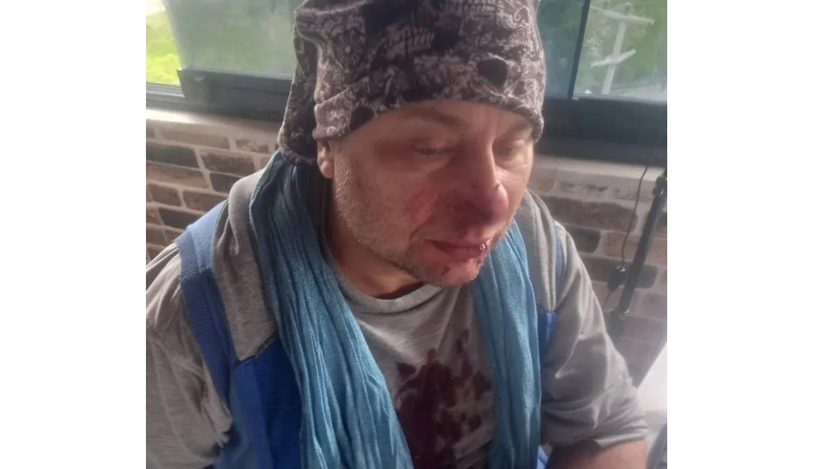 Onur Akay kimdir? Onur Akay'ın sağlık durumu nasıl?